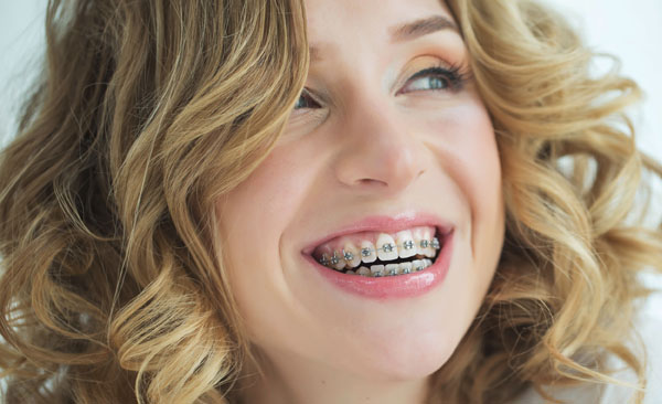 Read more about the article More Adults than Ever Have Braces or Invisalign